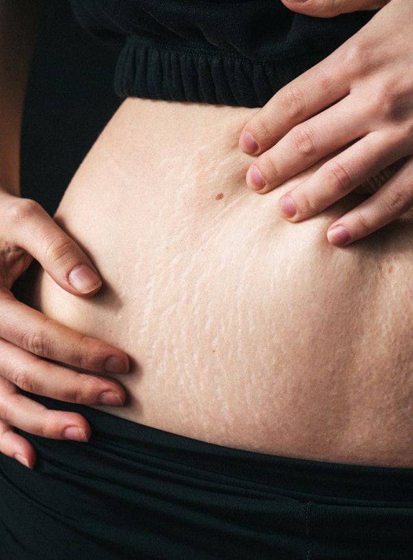 Formation Camouflage de vergetures et de cicatrices