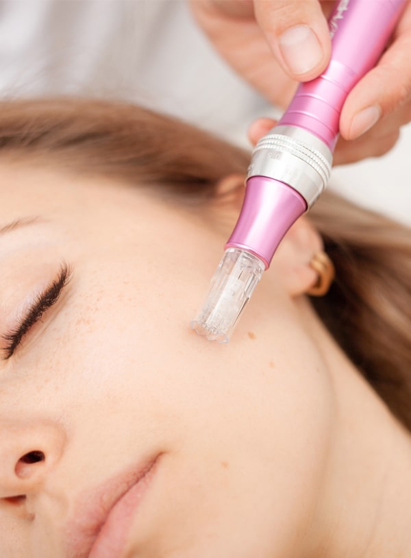 Formation Microneedling visage, corps et capillaire